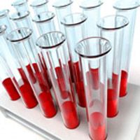 Что такое СОЭ в общем анализе крови
