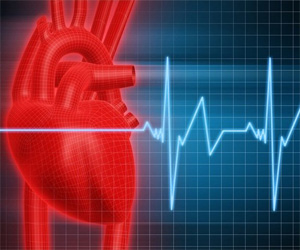 Что такое аритмия сердца